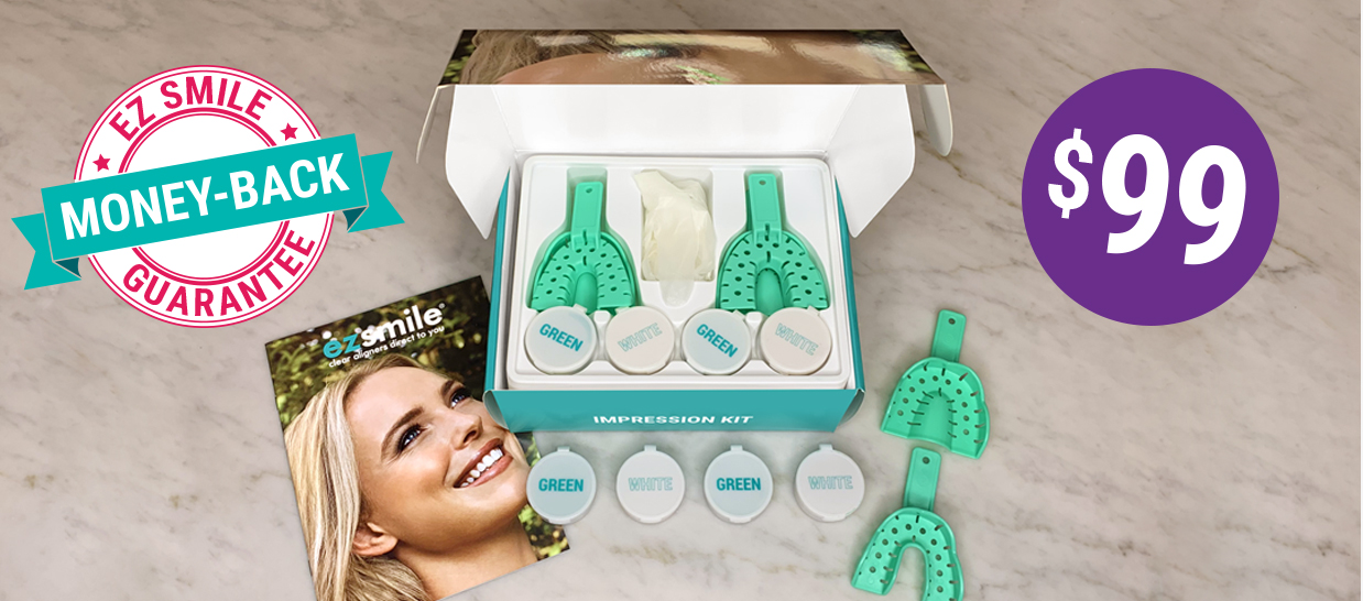 EZ Smile Impression Kit